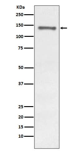 Anti-Raptor RPTOR Rabbit Monoclonal Antibody Boster Bio