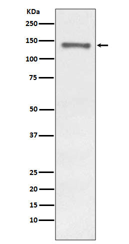 Anti-Raptor RPTOR Rabbit Monoclonal Antibody Boster Bio