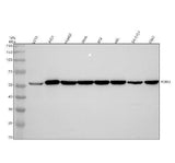 Anti-ERp57 PDIA3 Rabbit Monoclonal Antibody Boster Bio