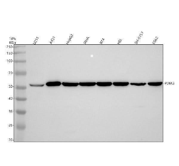 Anti-ERp57 PDIA3 Rabbit Monoclonal Antibody Boster Bio