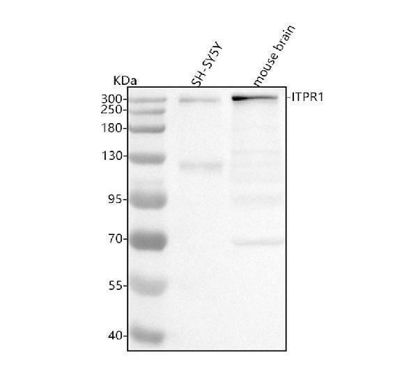 Anti-IP3 Receptor Rabbit Monoclonal Antibody Boster Bio