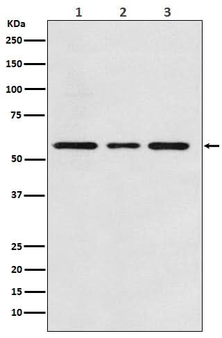 Anti-ACVRL1 Rabbit Monoclonal Antibody Boster Bio