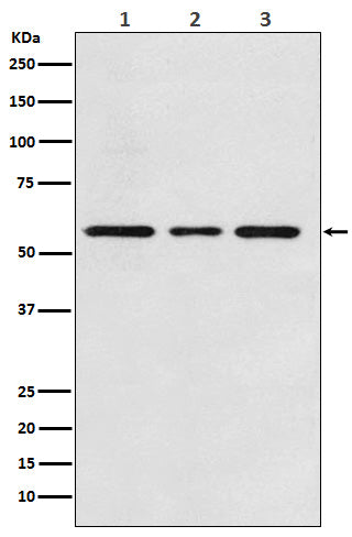 Anti-ACVRL1 Rabbit Monoclonal Antibody Boster Bio