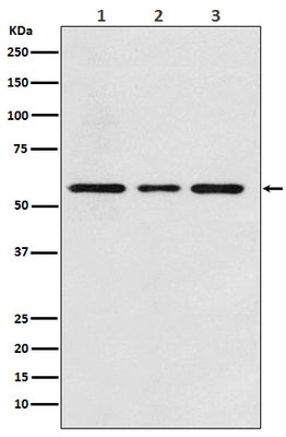 Anti-ACVRL1 Rabbit Monoclonal Antibody Boster Bio