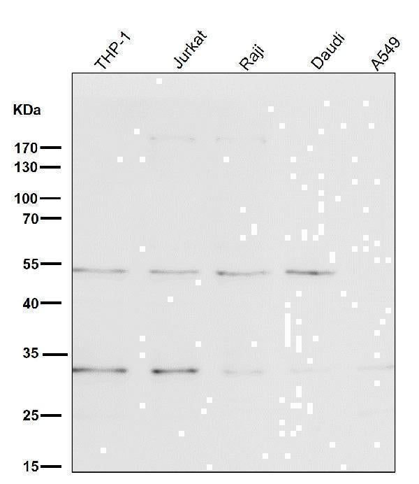 Anti-BNIP3 Rabbit Monoclonal Antibody Boster Bio