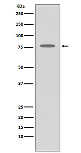 Anti-GRK2 ADRBK1 Rabbit Monoclonal Antibody Boster Bio
