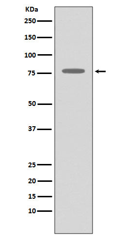 Anti-GRK2 ADRBK1 Rabbit Monoclonal Antibody Boster Bio
