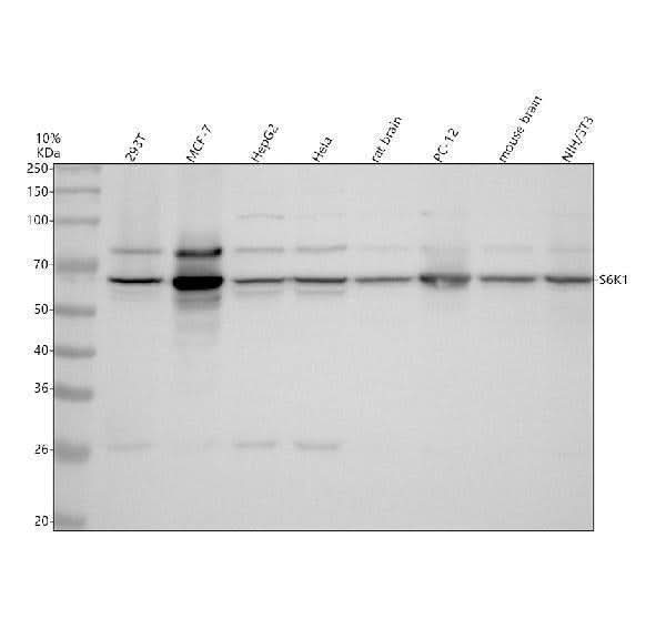 Anti-S6K1 RPS6KB1 Rabbit Monoclonal Antibody Boster Bio