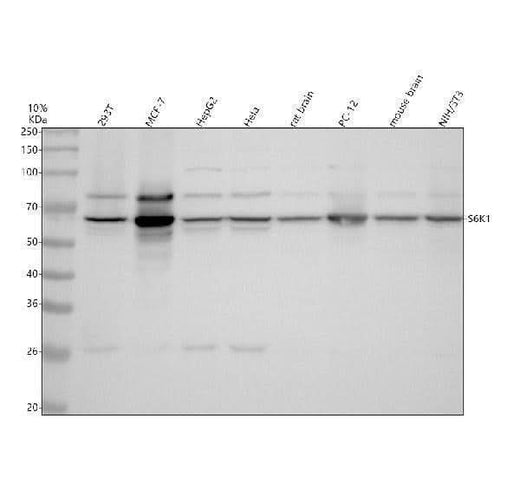 Anti-S6K1 RPS6KB1 Rabbit Monoclonal Antibody Boster Bio