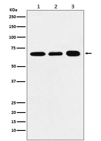 Anti-P70 S6 Kinase alpha Rabbit Monoclonal Antibody Boster Bio