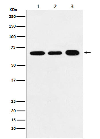 Anti-P70 S6 Kinase alpha Rabbit Monoclonal Antibody Boster Bio