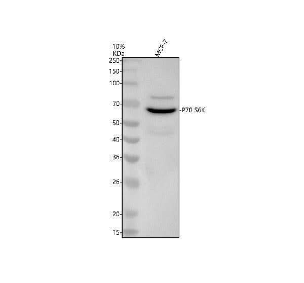 Anti-p70 S6 Kinase RPS6KB1 Rabbit Monoclonal Antibody Boster Bio