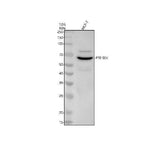 Anti-p70 S6 Kinase RPS6KB1 Rabbit Monoclonal Antibody Boster Bio