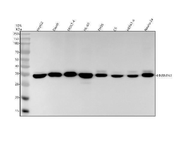 Anti-hnRNP A1 Rabbit Monoclonal Antibody Boster Bio