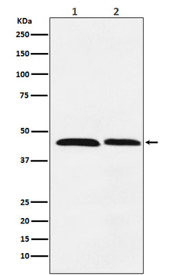 Anti-FEN1 Rabbit Monoclonal Antibody Boster Bio