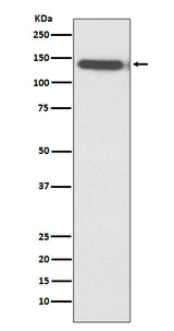 Anti-Ctip2 Rabbit Monoclonal Antibody Boster Bio