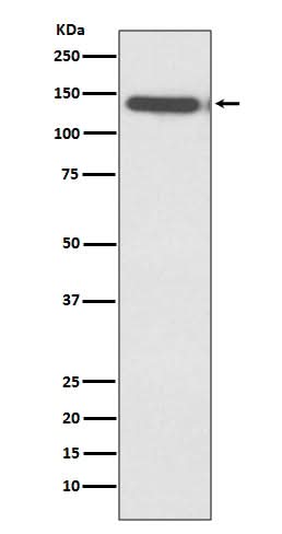 Anti-Ctip2 Rabbit Monoclonal Antibody Boster Bio