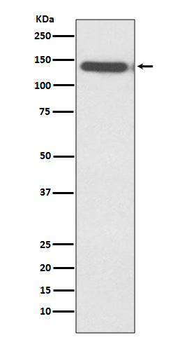 Anti-Ctip2 Rabbit Monoclonal Antibody Boster Bio