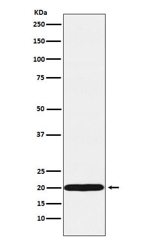 Anti-UBE2C Rabbit Monoclonal Antibody Boster Bio