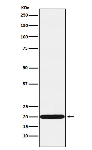 Anti-UBE2C Rabbit Monoclonal Antibody Boster Bio