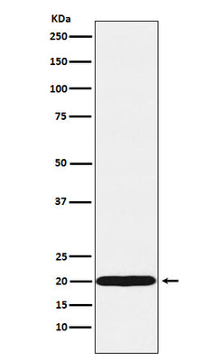 Anti-UBE2C Rabbit Monoclonal Antibody Boster Bio