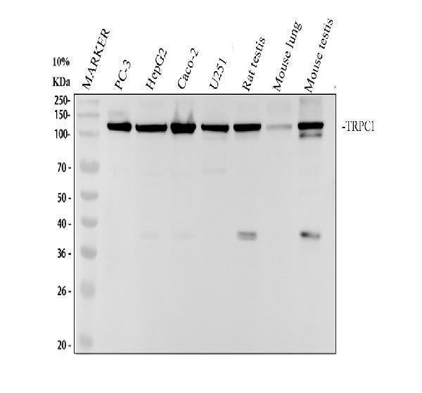 Anti-TRPC1 Rabbit Monoclonal Antibody Boster Bio