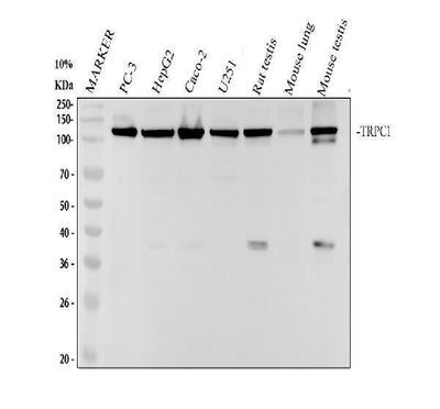 Anti-TRPC1 Rabbit Monoclonal Antibody Boster Bio