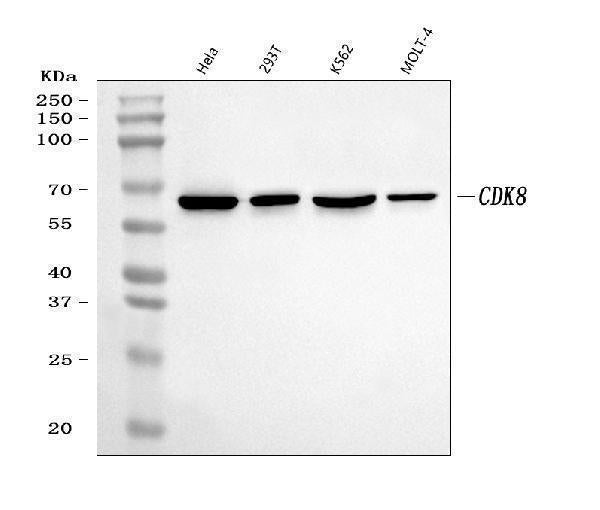Anti-CDK8 Rabbit Monoclonal Antibody Boster Bio