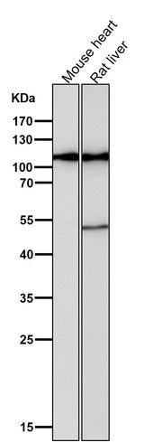 Anti-Hexokinase 1 HK1 Rabbit Monoclonal Antibody Boster Bio