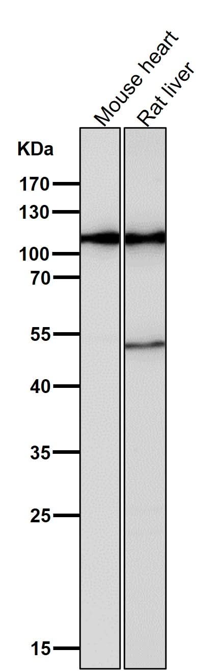 Anti-Hexokinase 1 HK1 Rabbit Monoclonal Antibody Boster Bio