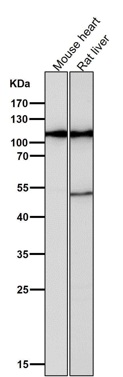 Anti-Hexokinase 1 HK1 Rabbit Monoclonal Antibody Boster Bio