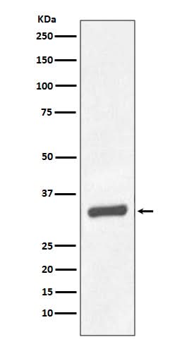 Anti-PSA/KLK3 Rabbit Monoclonal Antibody Boster Bio