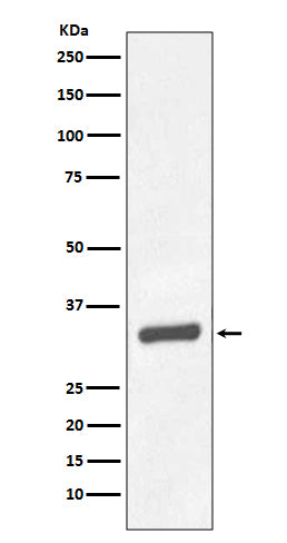 Anti-PSA/KLK3 Rabbit Monoclonal Antibody Boster Bio