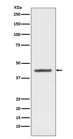 Anti-HMBS Rabbit Monoclonal Antibody Boster Bio