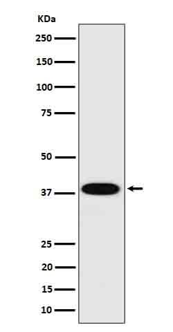 Anti-Cathepsin H Rabbit Monoclonal Antibody Boster Bio