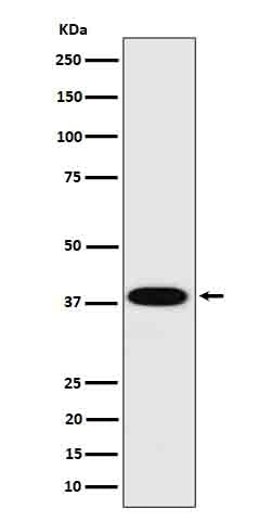 Anti-Cathepsin H Rabbit Monoclonal Antibody Boster Bio