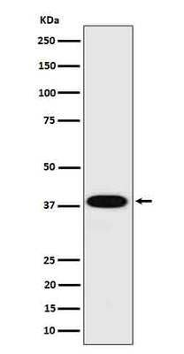 Anti-Cathepsin H Rabbit Monoclonal Antibody Boster Bio