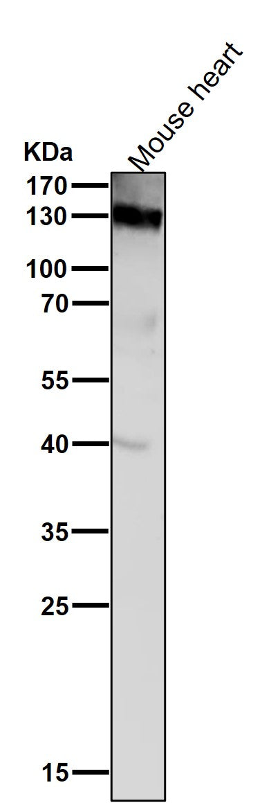 Anti-CD31 PECAM1 Rabbit Monoclonal Antibody Boster Bio