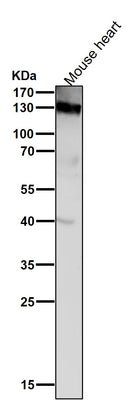 Anti-CD31 PECAM1 Rabbit Monoclonal Antibody Boster Bio