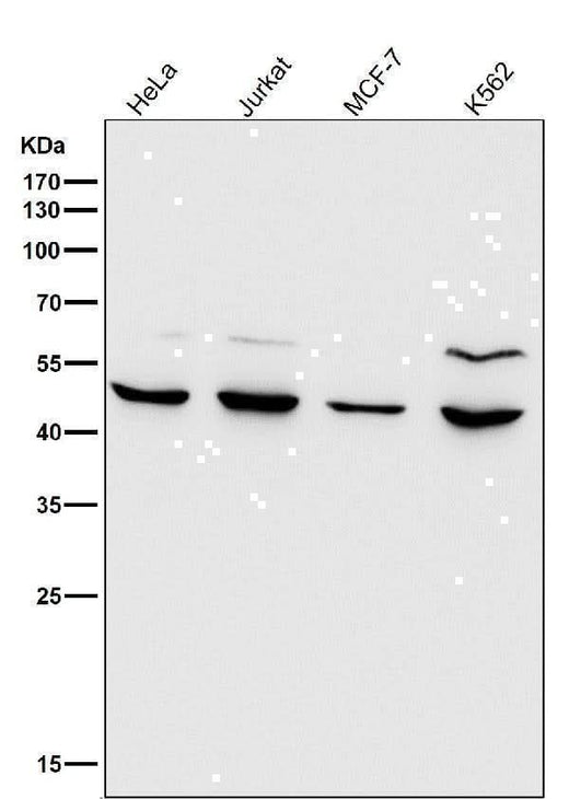 Anti-MMP12 Rabbit Monoclonal Antibody Boster Bio