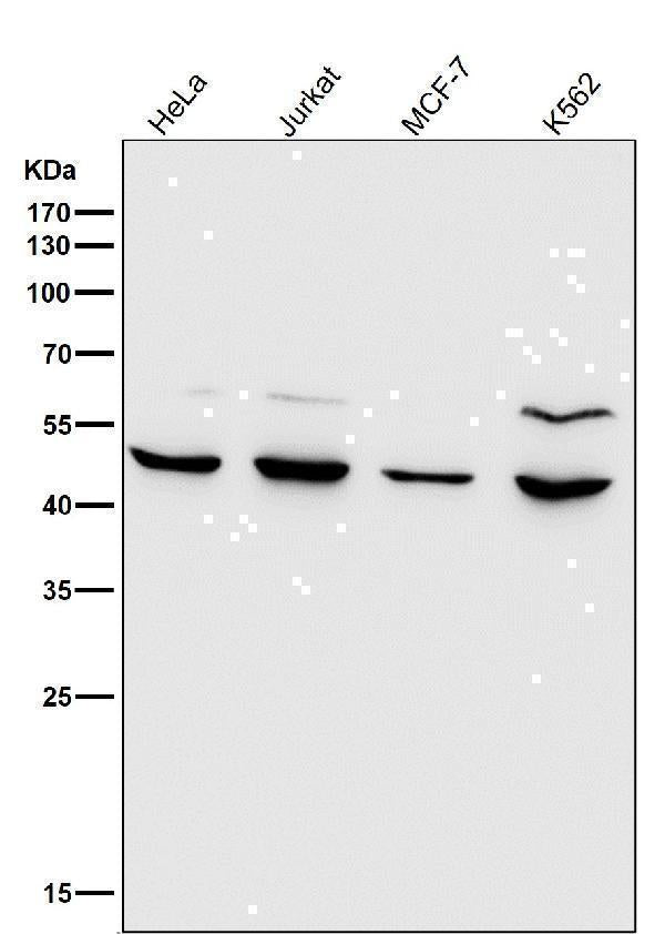 Anti-MMP12 Rabbit Monoclonal Antibody Boster Bio