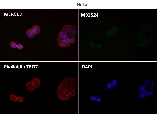 Anti-LC3B MAP1LC3B Rabbit Monoclonal Antibody Boster Bio