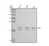 Anti-Cofilin Rabbit Monoclonal Antibody Boster Bio