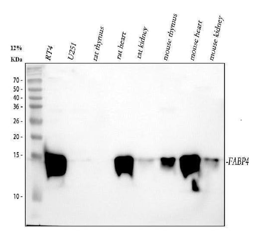 Anti-FABP4/A Fabp Rabbit Monoclonal Antibody Boster Bio