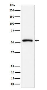 Anti-CAP1 Rabbit Monoclonal Antibody Boster Bio