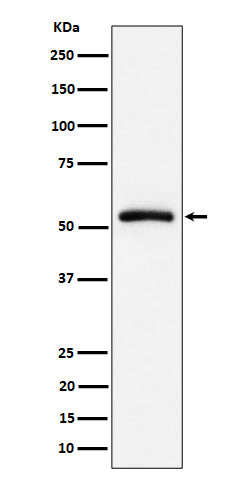 Anti-CAP1 Rabbit Monoclonal Antibody Boster Bio