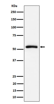 Anti-CAP1 Rabbit Monoclonal Antibody Boster Bio
