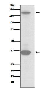 Anti-RON Rabbit Monoclonal Antibody Boster Bio