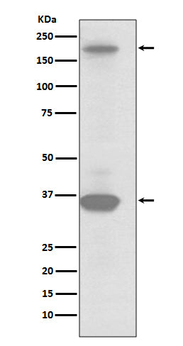 Anti-RON Rabbit Monoclonal Antibody Boster Bio