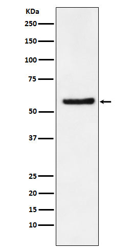 Anti-DKC1 Rabbit Monoclonal Antibody Boster Bio
